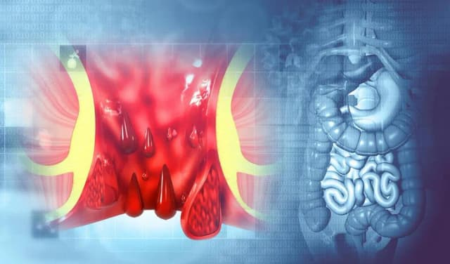 Selles rouges après betteraves : combien de temps cela dure-t-il ? Selles rouges après betteraves : combien de temps cela dure-t-il ?